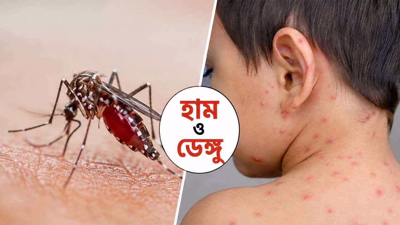 ডেঙ্গু-হামের দ্বৈত চাপ, ২৪ ঘণ্টায় মৃত্যু ১৭